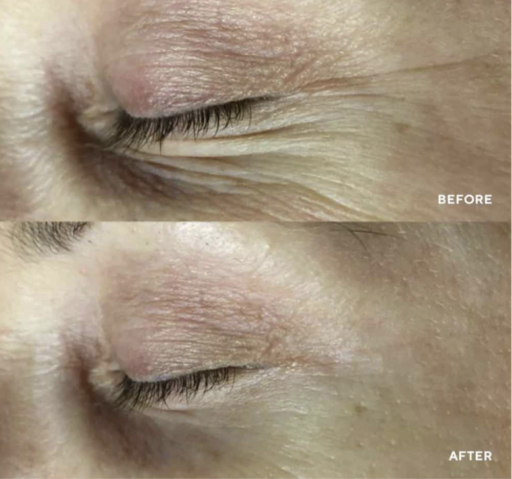 Ajándék Minta Arcpakolás Polipeptid Face Collagel 1 db<br>Kollagénes és hidratáló arcpakolás, amely sejtszinten, egészen a DNS-ig hatékony