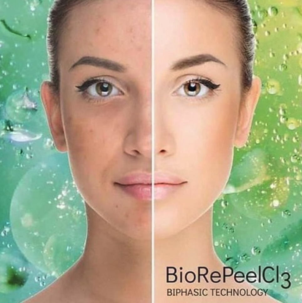 BIOREPEELCL3 FND / 5 pcs x 6 ml. 
Orvosi-kémiai TCA peeling 5 ampullával, szabadalmaztatott kétszakaszos technológiával, megerősített klinikai vizsgálatokkal. Orvostechnikai eszköz.