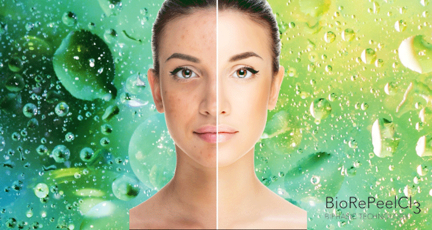 BioRePeelCl3 BODY<br>Innovatív kétfázisú peeling és biorevitalizáció egyben<br>3 x 12ml