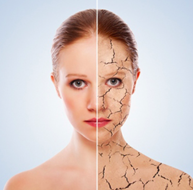 MD:Peel Potokol Treatment Video 
Kémiai peeling MD:Ceuticals