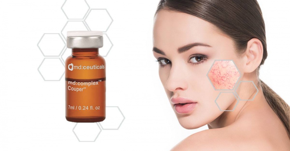 MD:CEUTICALS MD:COMPLEX COUPER OFF 
Koktél a rosacea kezelésére<br>Csökkenti a bőrpírt, enyhíti a gyulladást