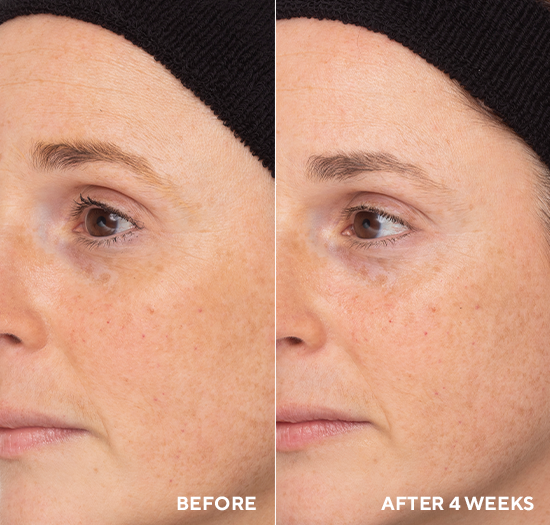 TRAVEL HYDROPEPTIDE RETINOL ROUTINE BOOSTER 
Retinol szérum CellRenew-16-nal és hialuronsavval a ráncok ellen