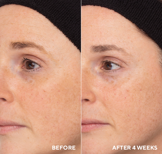 Professional Retinol Eye Renewal <br> Profi feszesítő szembalzsam lifting hatással