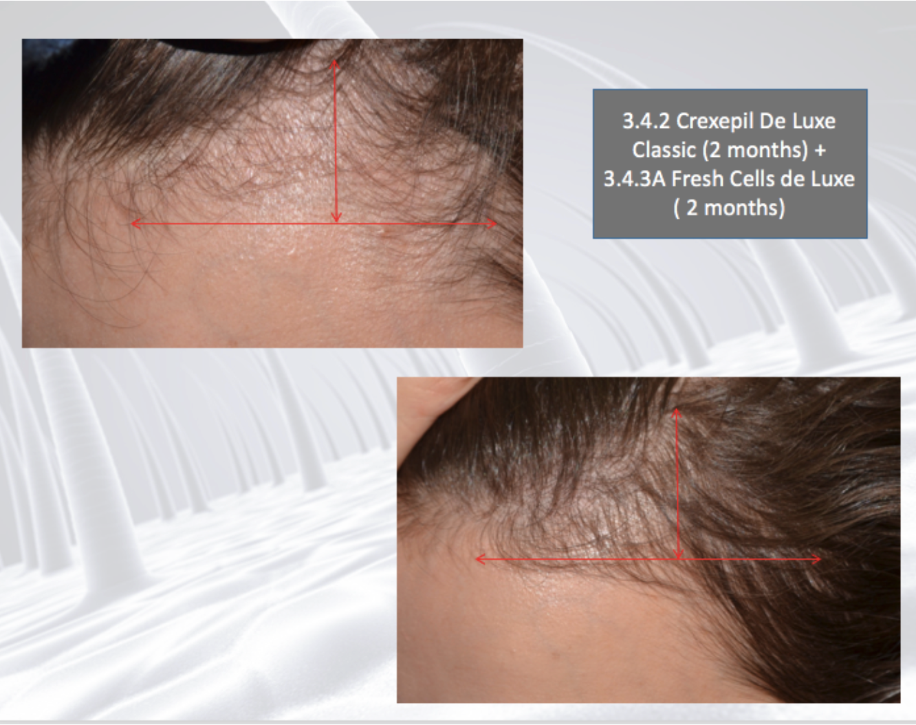 DSD SIMONE DE LUXE WONDERCELL LOTION 
3.4.3A  Hajtrágya a haj növekedéséhez. Hidratálás és a haj növekedésének stimulálása.