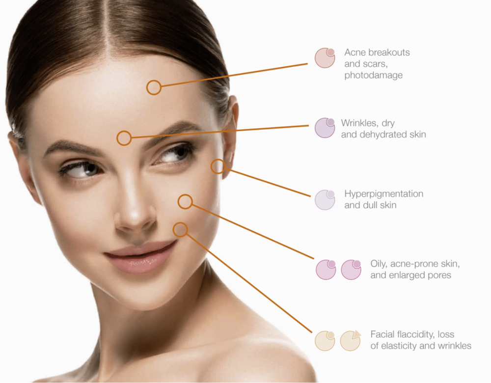 PBSERUM SMARTKER EXTREME FIRMNESS<br>Lifting, ránc- és pigmentációcsökkentés<br>5 amp x 0.70g/5 amp x 3ml