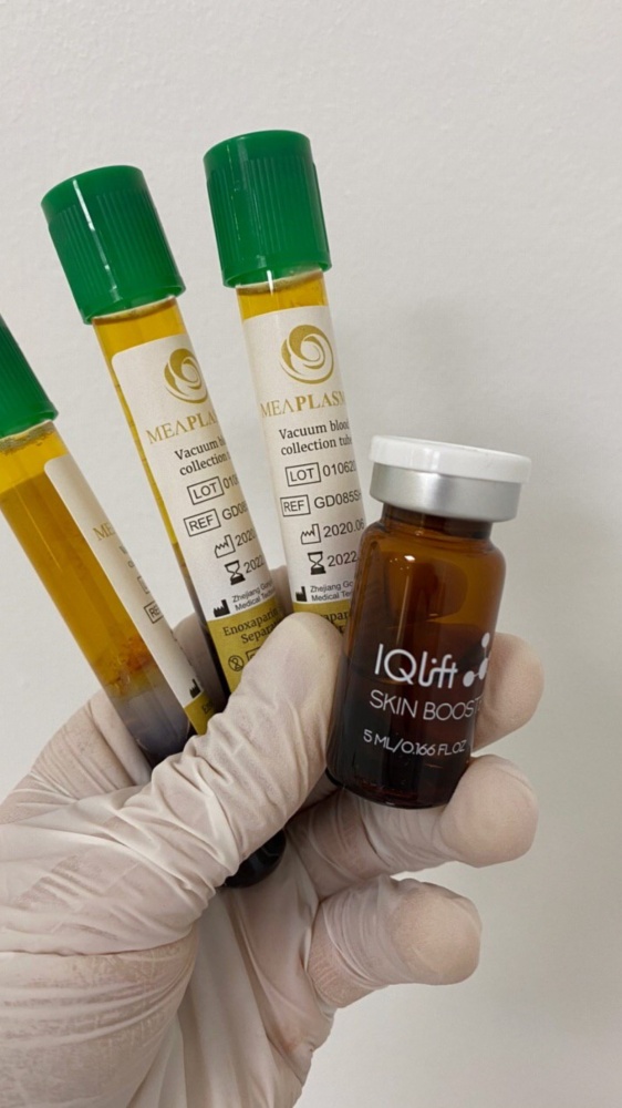 Meaplasma PRGF<br>Autonóm PRGF vérplazma<br>PlasmaTherapy - előállítására való kémcsövek, 1 darab