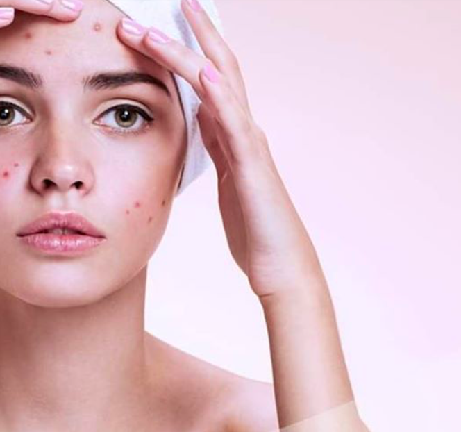 MD:CEUTICALS md:COMPLEX SKINCLEAR 
Akné, zsíros bőr